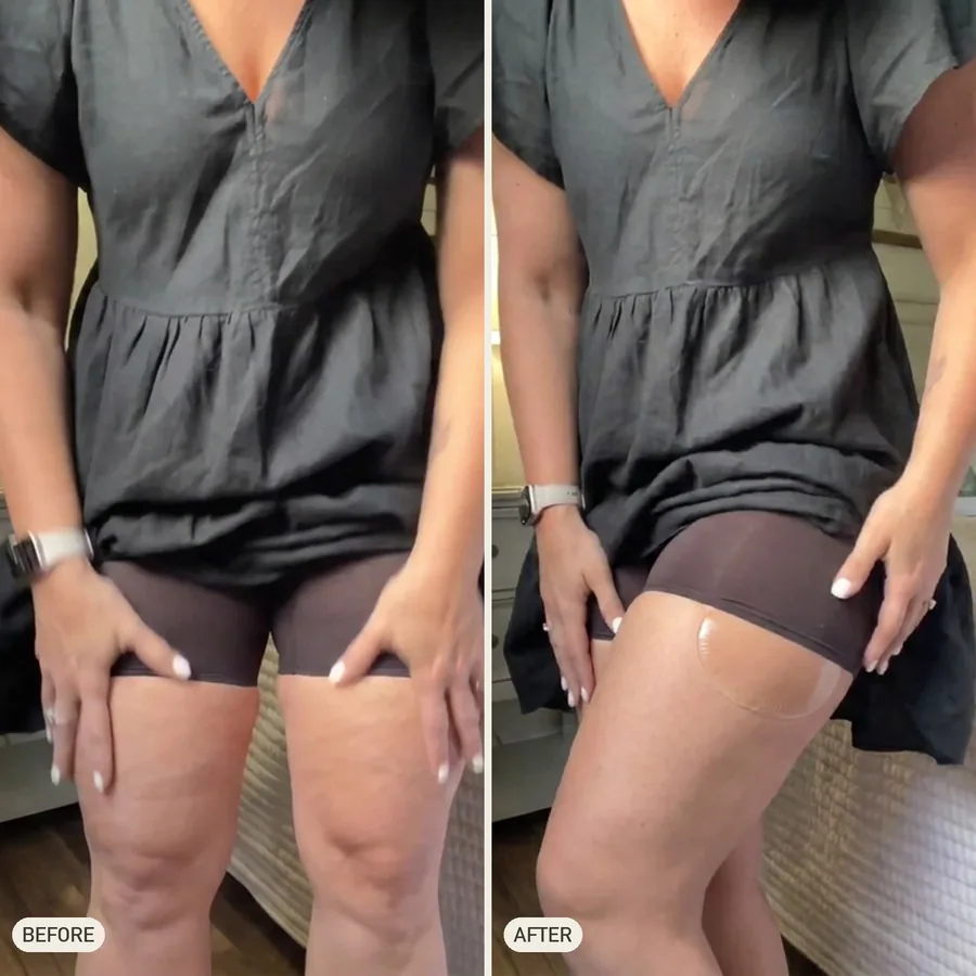 Megan L. before and after